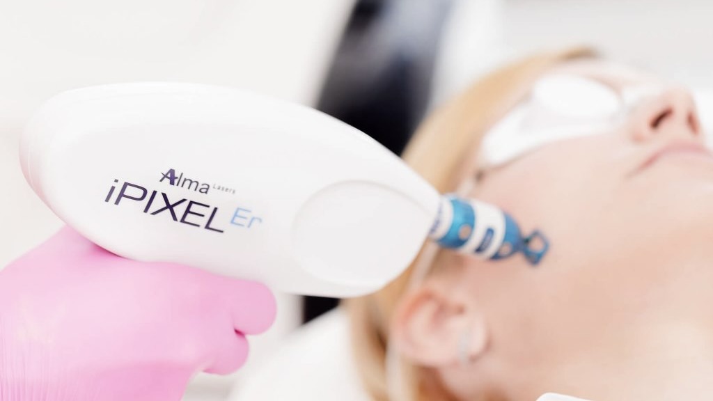 iPixel scar laser treatment at Evolution Aesthetics Clinic