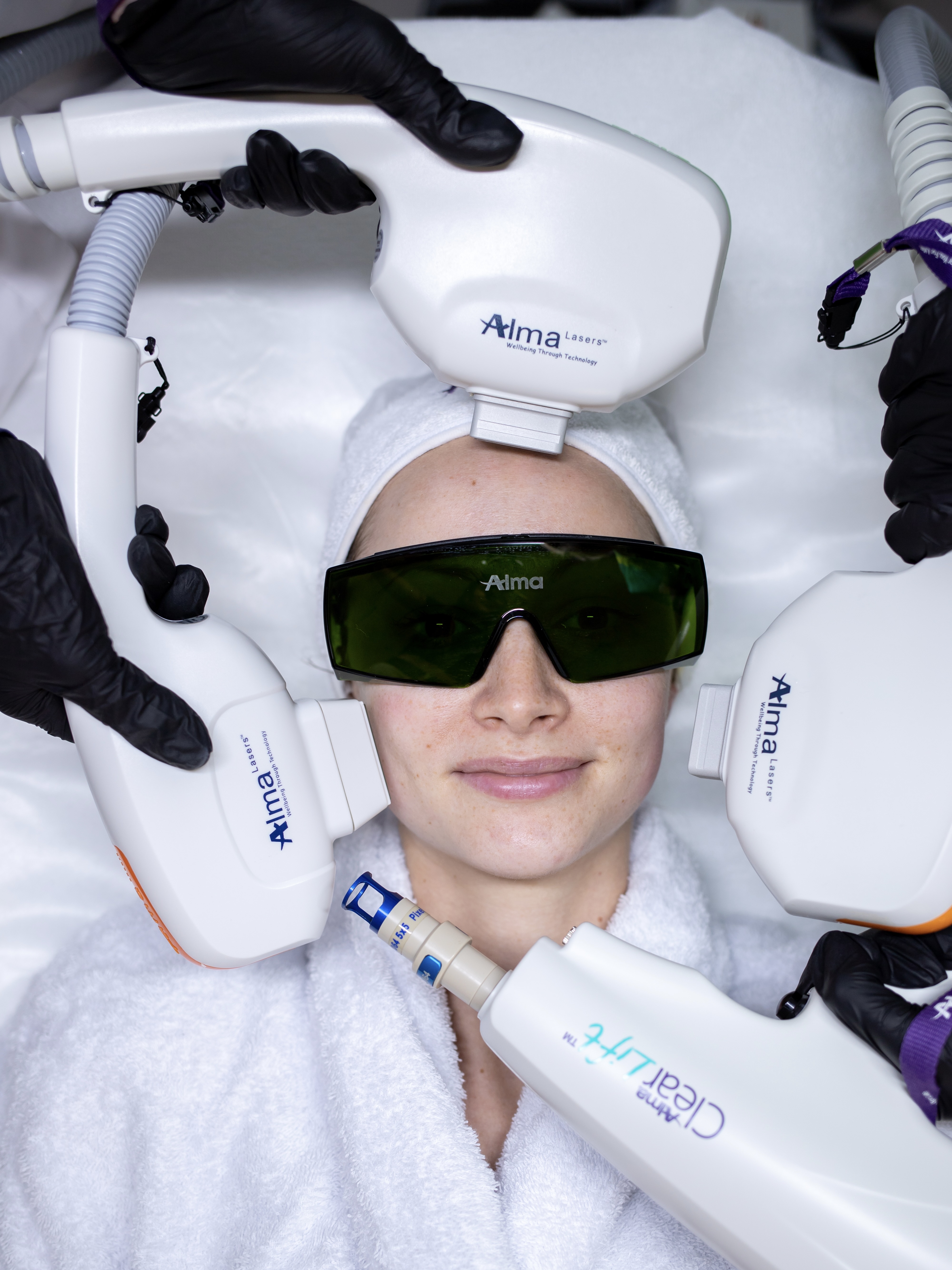 No Filters laser treatment at Evolution Aesthetics Clinic