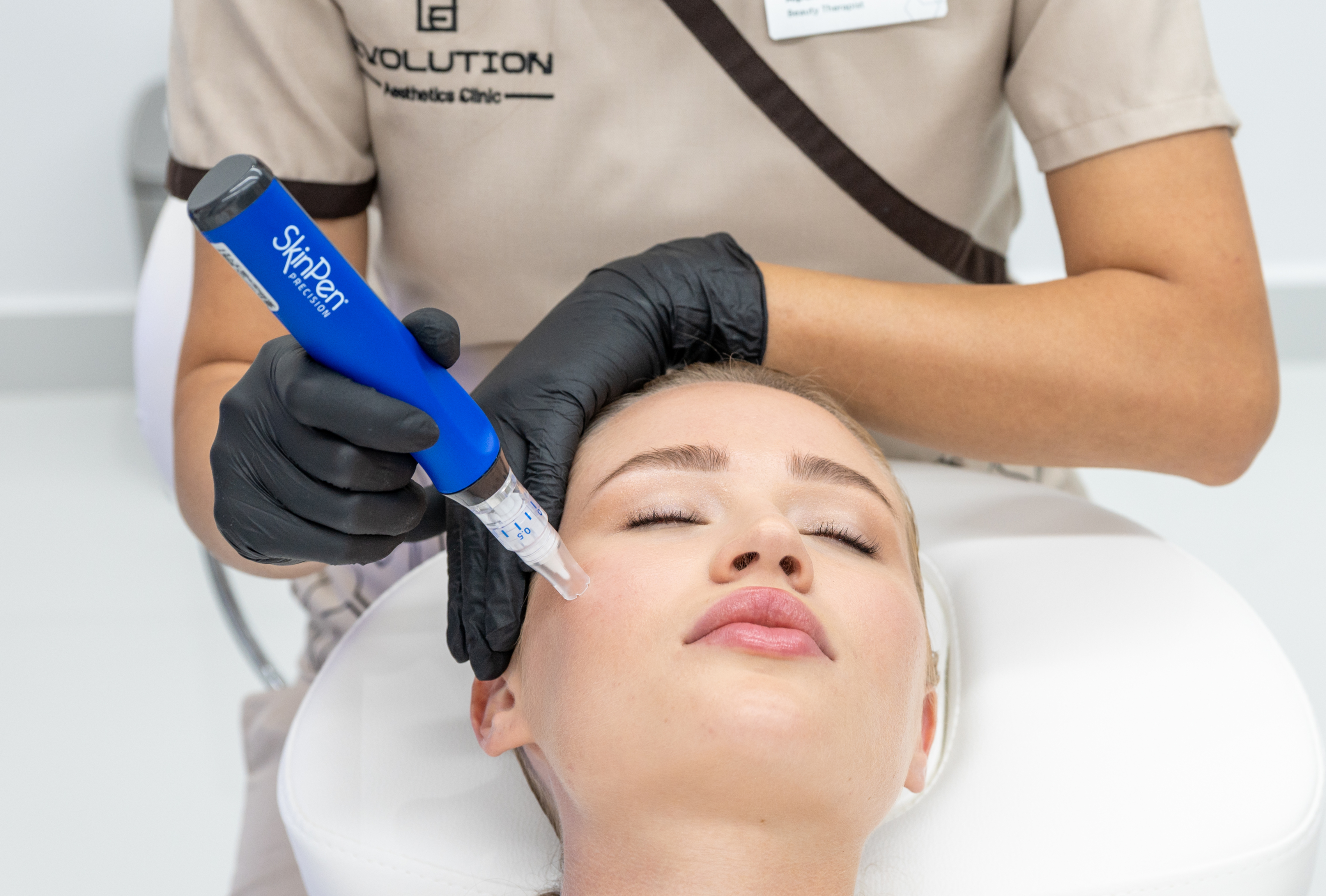 SkinPen microneedling at Evolution Aesthetics Clinic