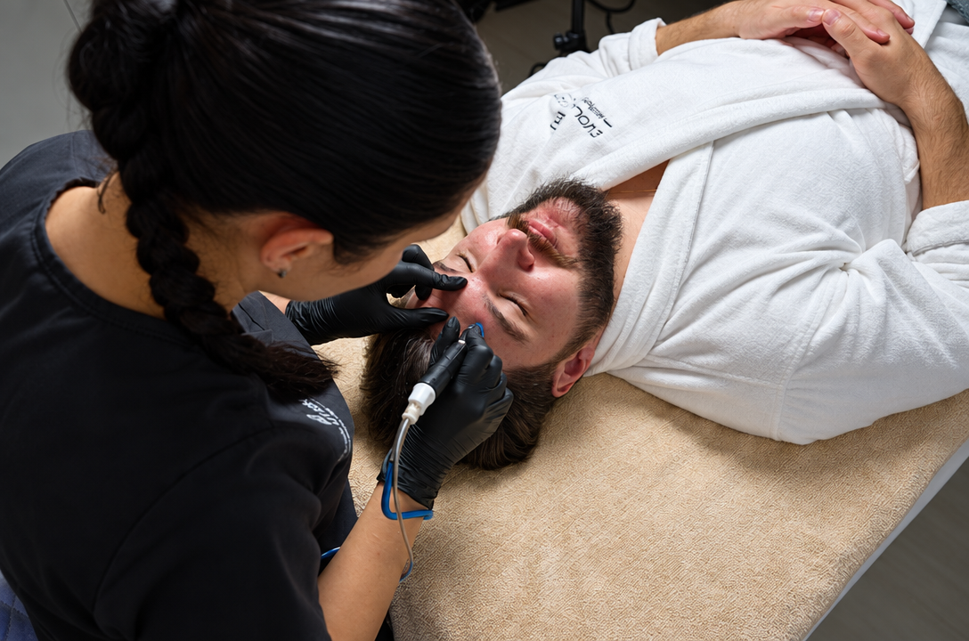 HydraFacial treatment image at Evolution Aesthetics Clinic
