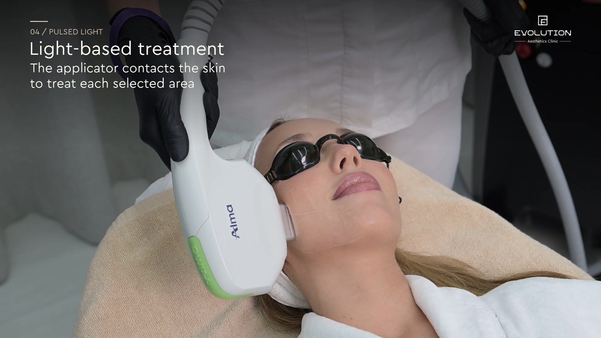 No Filters laser treatment at Evolution Aesthetics Clinic