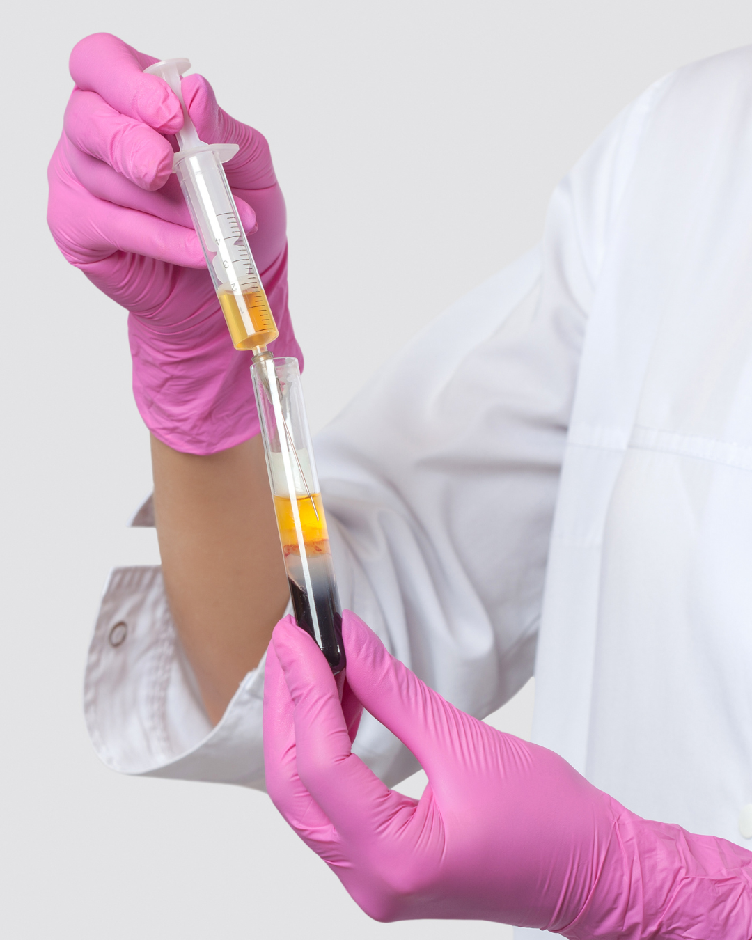 Clinician holding a plasma syringe and blood collection tube