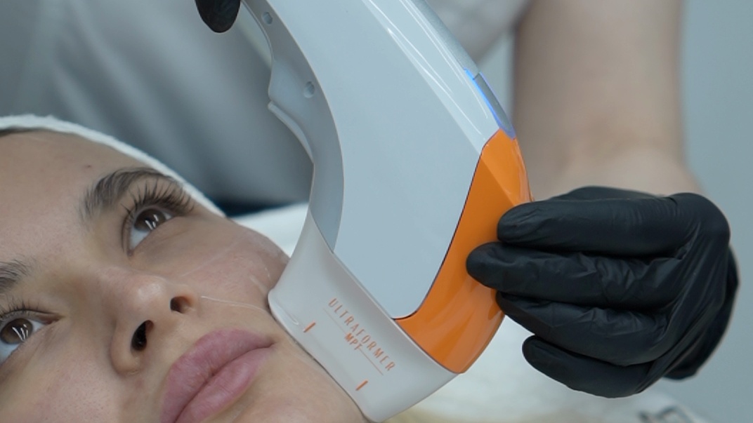 Ultraformer MPT handpiece applied to a patient’s cheek at Evolution Clinic