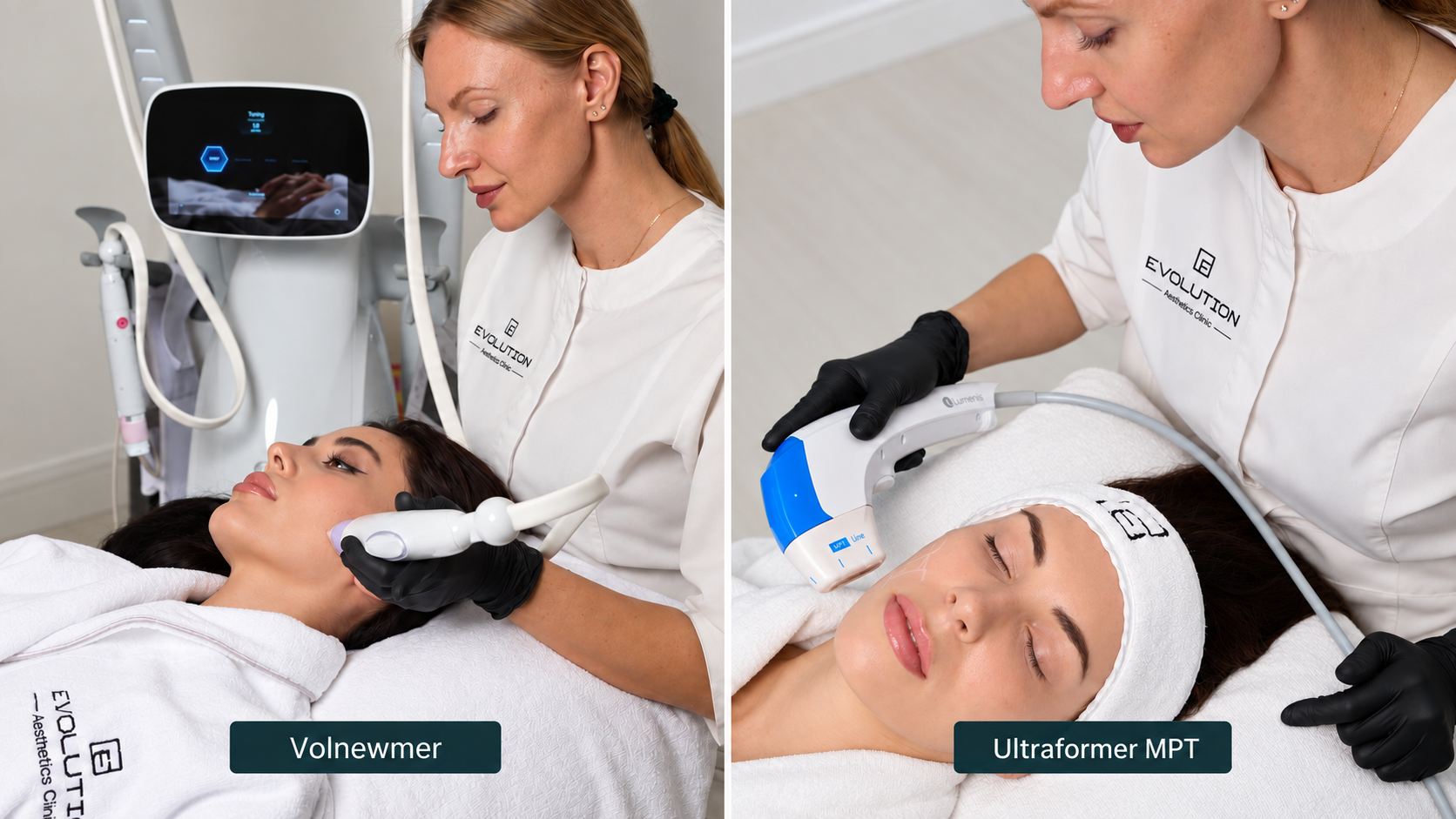 Close views of a clinician using Volnewmer on the left and a blue Ultraformer MPT handpiece on the right during facial treatment.
