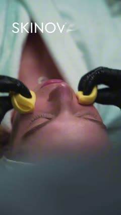 Dr Julia Krasnaya explaining Skinova LDM: Ultrasound Skin Treatment Explained