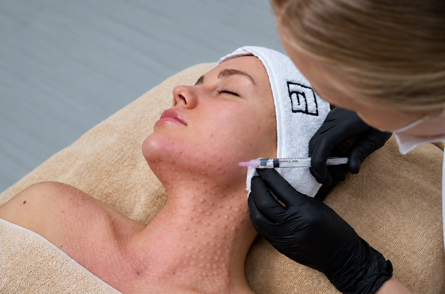Plinest polynucleotide skin booster at Evolution Aesthetics Clinic