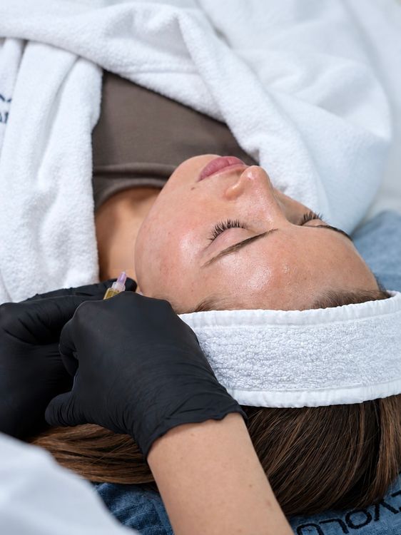 Doctor holding a syringe of platelet-rich plasma beside a patient's cheek before a PRP facial