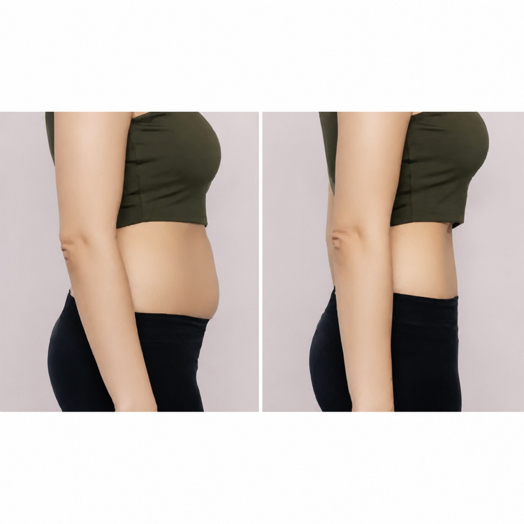 12 sessions before and after treatment result
