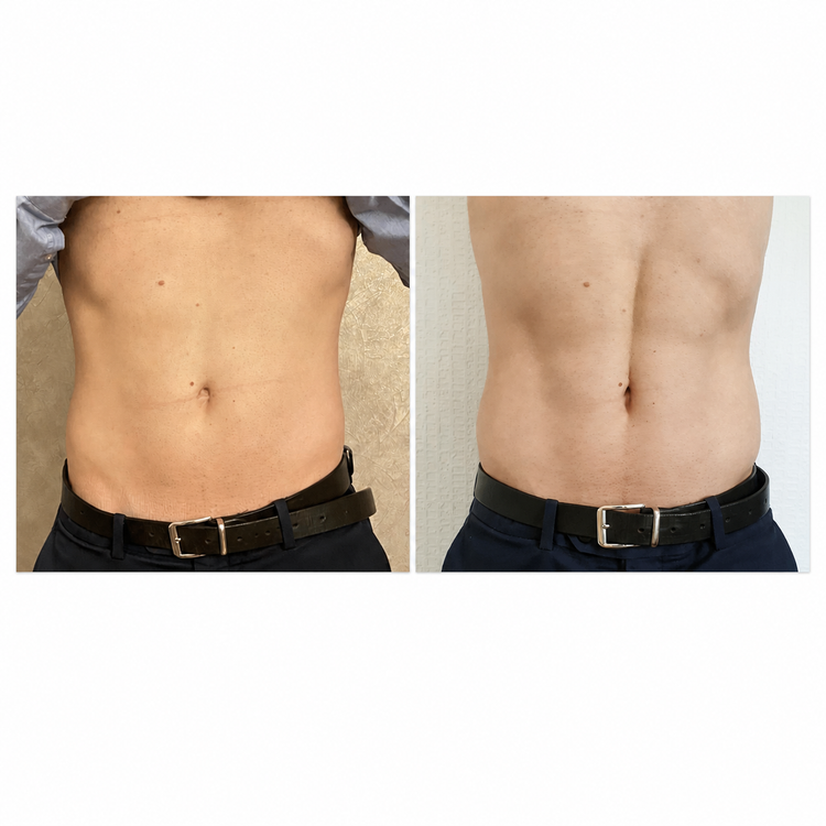 8 sessions before and after treatment result