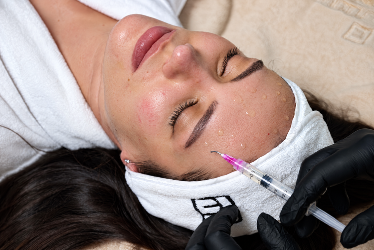 Needle-free syringe placing droplets of PRX‑T33 on a woman's cheek