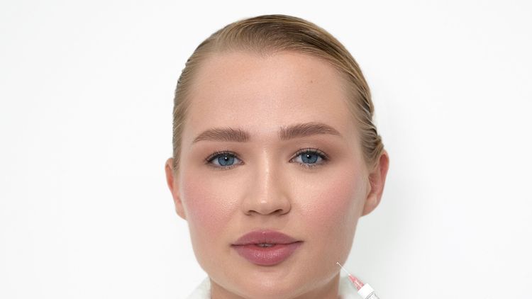 Woman's face with a fine needle approaching the cheek before a Jalupro Classic skin booster injection