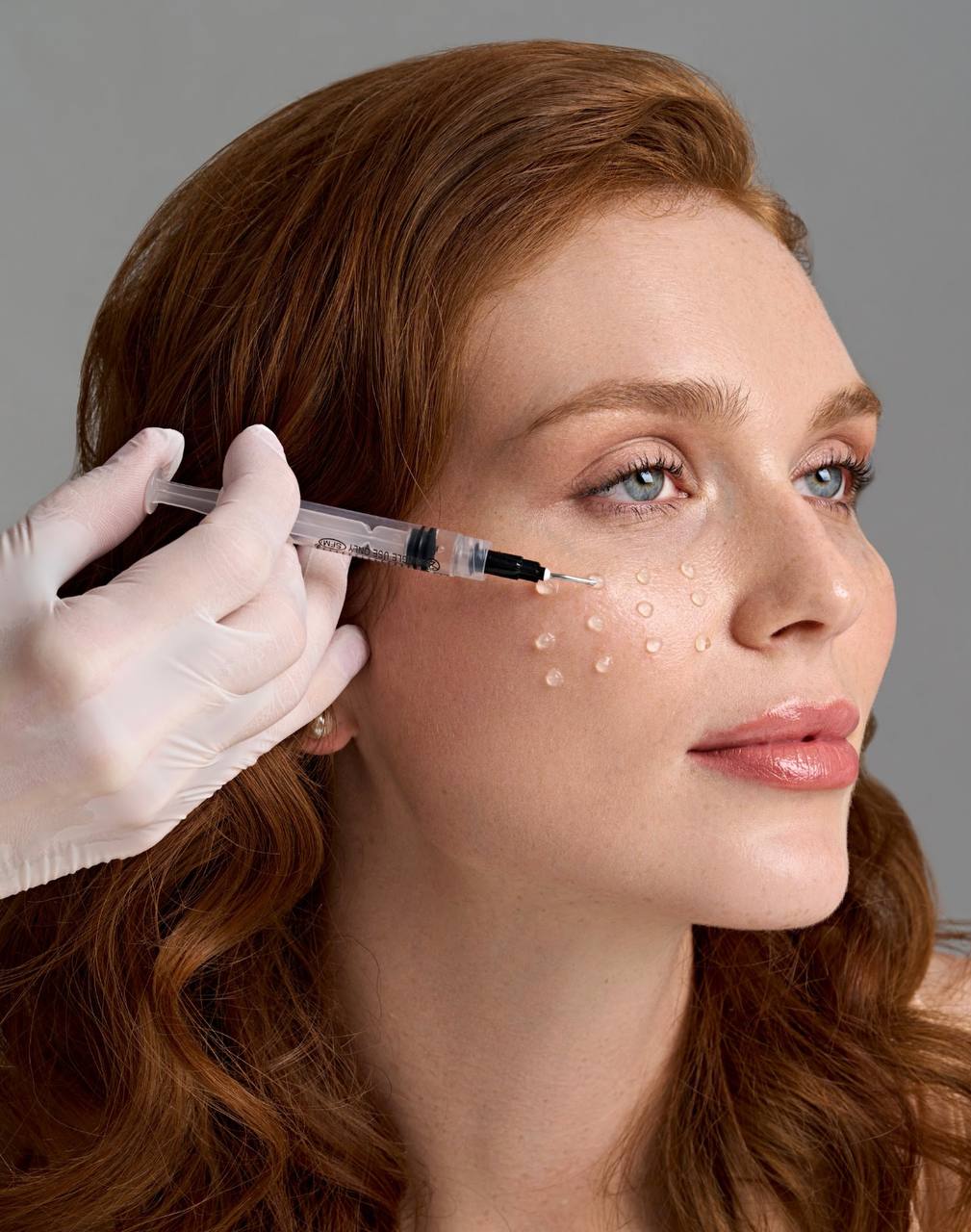 PRX-T33 medium-depth peel at Evolution Aesthetics Clinic