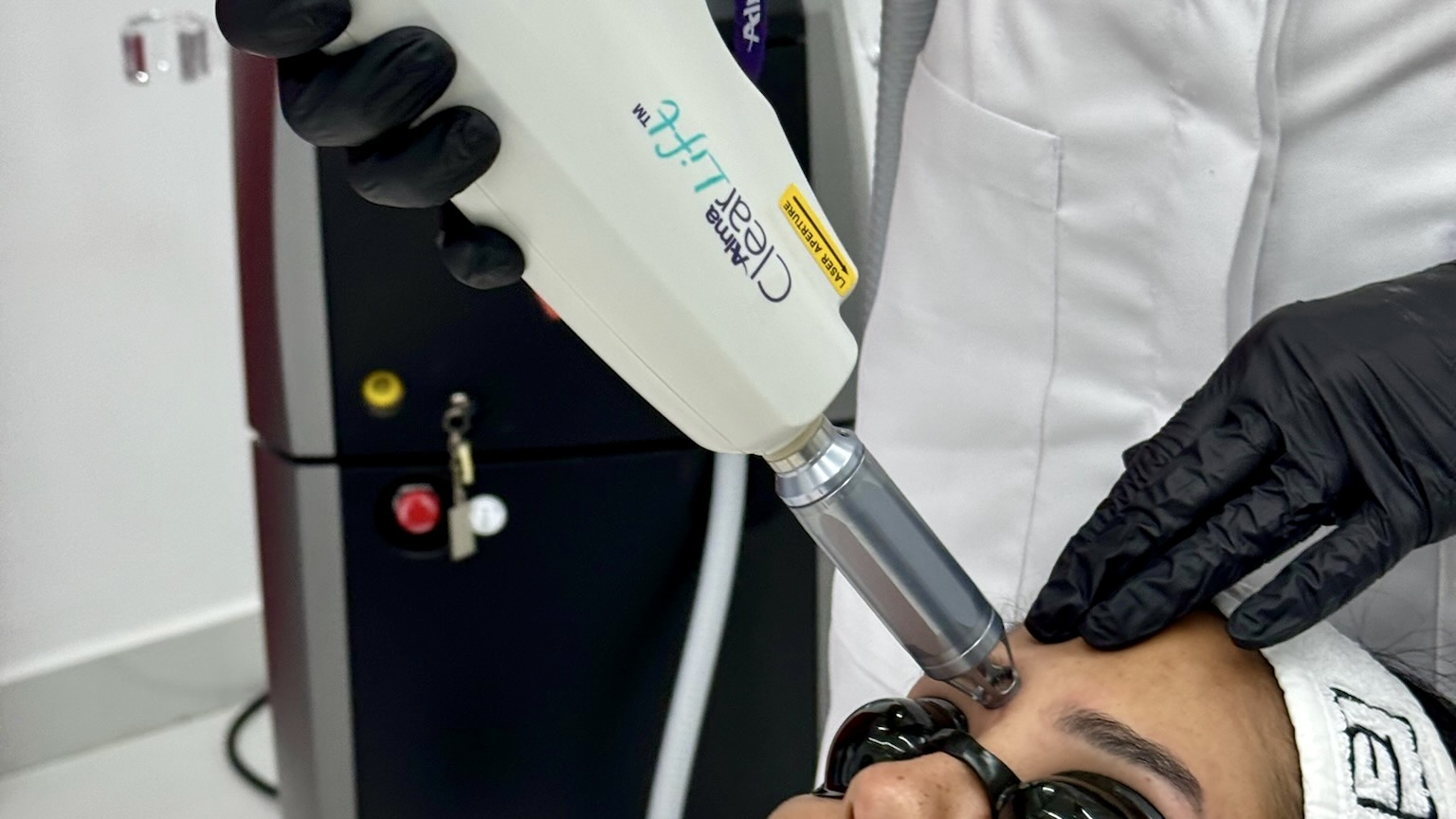Laser removal treatment of eyebrow permanent makeup