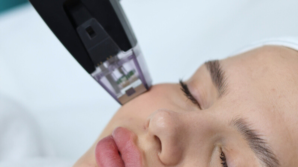 Close view of a Morpheus8 facial treatment handpiece
