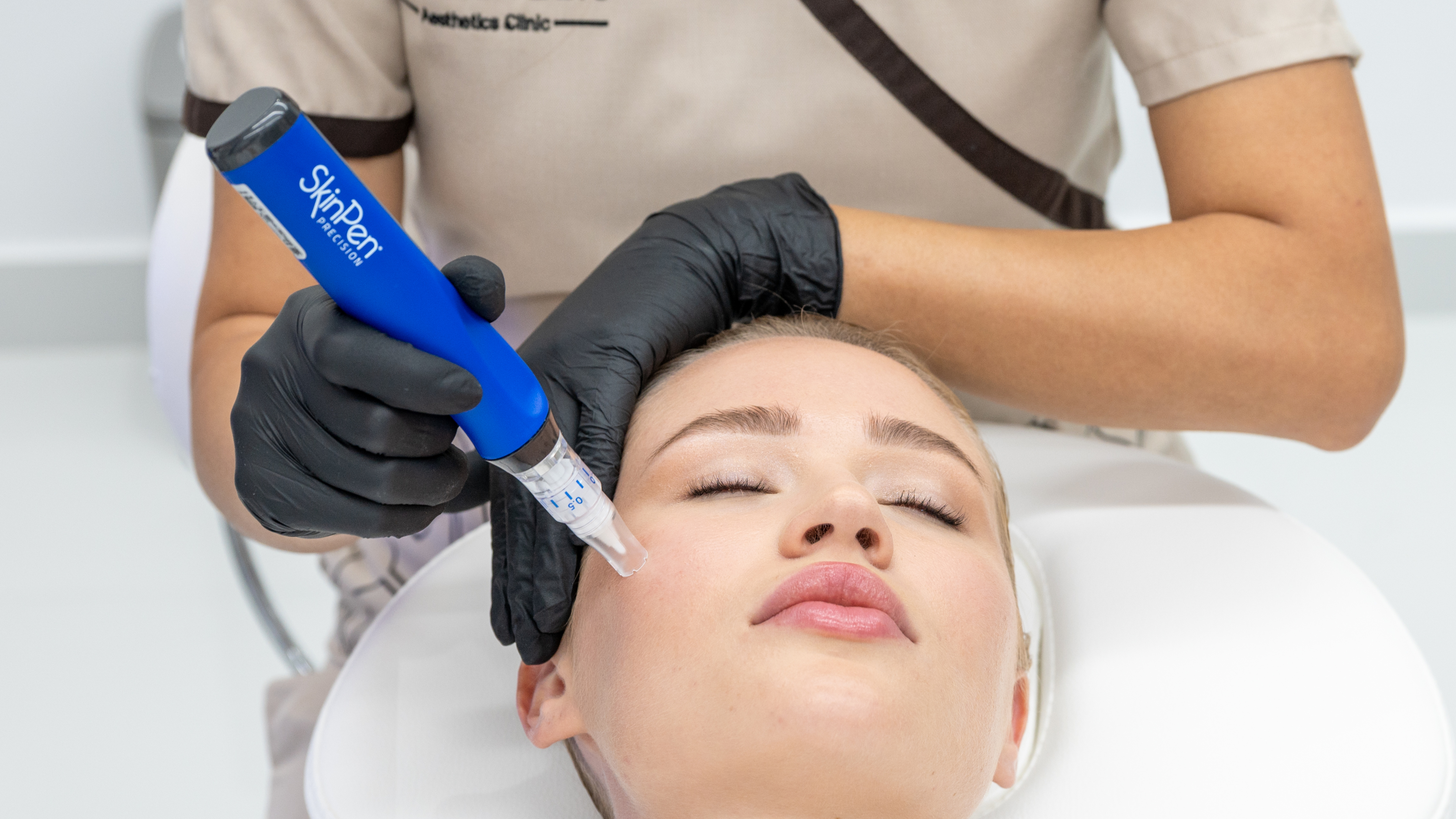 SkinPen microneedling treatment on the face