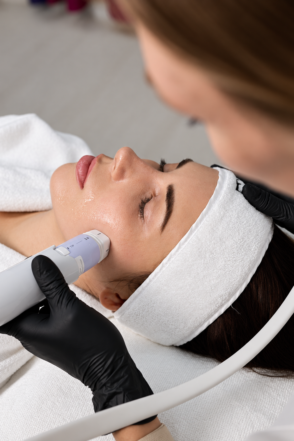 Close-up of a clinician applying a Volnewmer handpiece to a patient’s cheek at Evolution Aesthetics Clinic.
